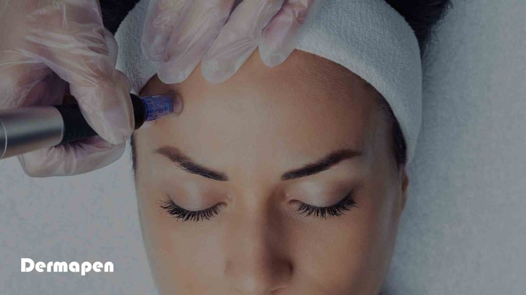 Dermapen tretman - Aktivira prirodnu regeneraciju za mladalacki ten