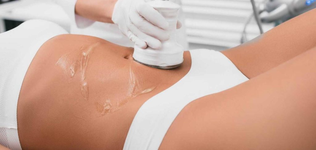 Kavitacija tretman Niš – Brzo mršavljenje bez operacije i yo-yo efekta